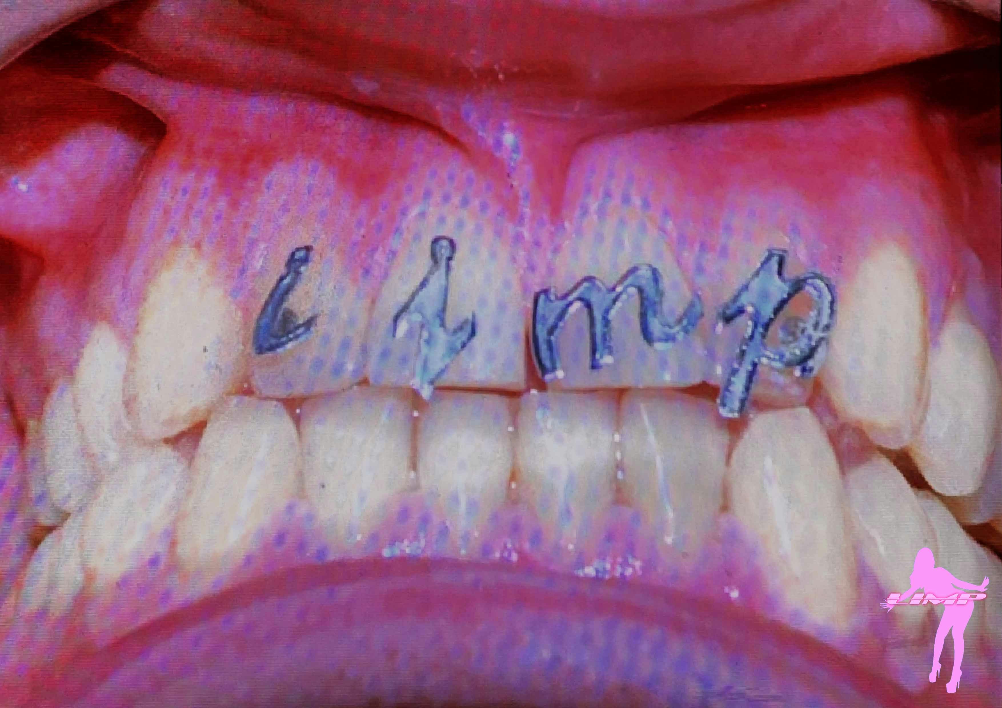 LIMP